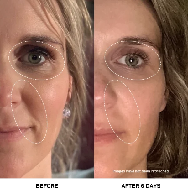 Advanced Rejuvenating Power Treatment 05 – Bild 6